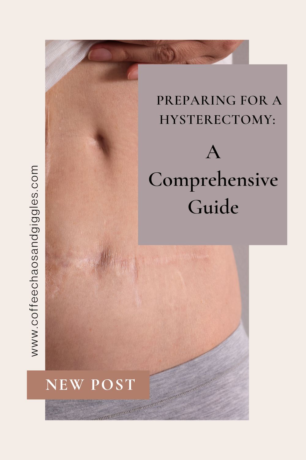 Preparing for a Hysterectomy: A Comprehensive Guide